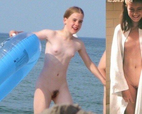 Bare Lake Days photos - Naturism teaches us to accept differences and imperfections without shame or insecurities